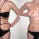 Illustration for article titled The Strappy Swimsuit Trend Creates the Worlds Worst Tan Lines